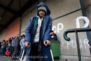 A young refugee with a broken leg from an accident during a police chase after being made homeless after the clearing of the Jungle. France.
© Jess Hurd/reportdigital.co.uk
Tel: 01789-262151/07831-121483  
info@reportdigital.co.uk  
NUJ recommended terms & conditions apply. Moral rights asserted under Copyright Designs & Patents Act 1988. Credit is required. No part of this photo to be stored, reproduced, manipulated or transmitted by any means without permission.